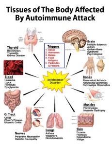 malattie_autoimmuni_intestino